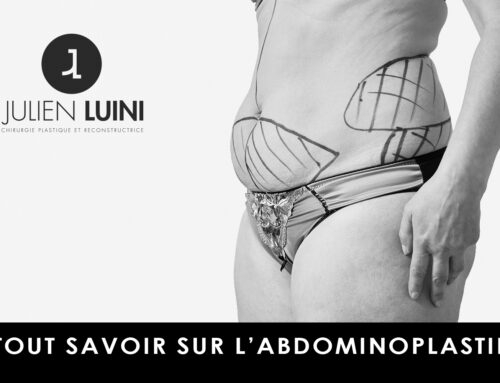 Abdominoplastie et chirurgie de la paroi abdominale : analyse médicale du Dr Julien Luini
