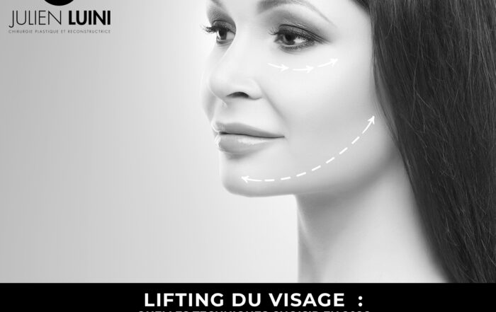 Lifting du visage à Cagnes-sur-Mer