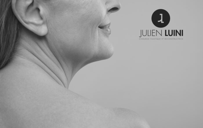 lifting cervicofacial à Cagnes sur Mer